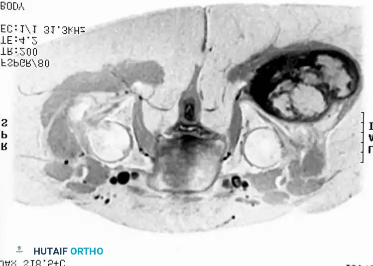 Hutaifortho's Orthopaedic Diagram