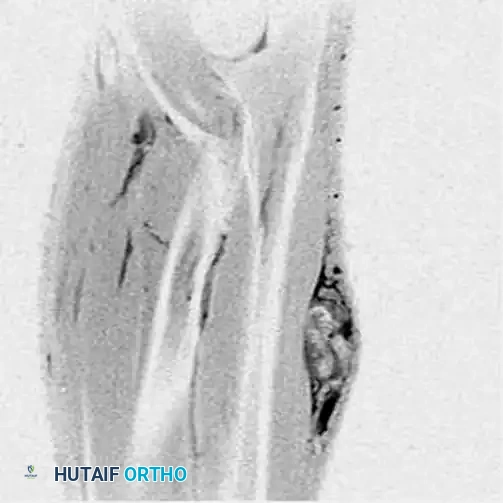 Hutaifortho's Orthopaedic Diagram
