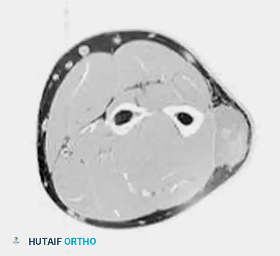 Hutaifortho's Orthopaedic Diagram