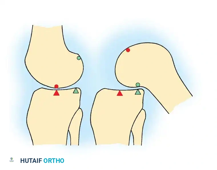 Knee Biomechanics and Kinematics: A Comprehensive Surgical Guide