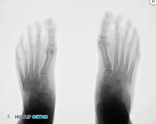 Alternative Postoperative Lateral Radiograph