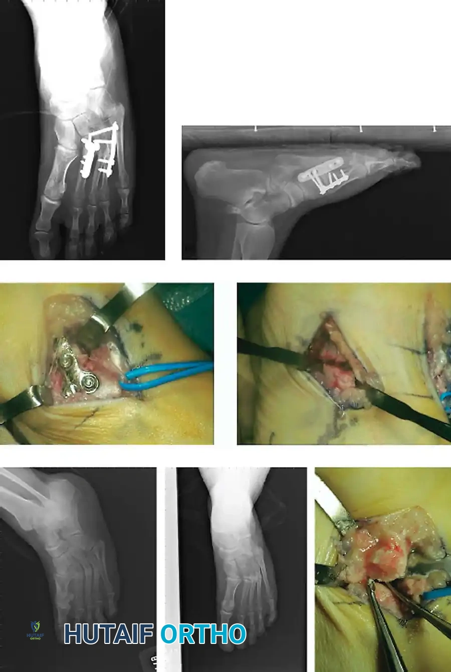 Hutaifortho's Orthopaedic Diagram