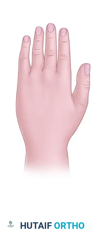 Methods and Indications for Orthopedic Skin Closure