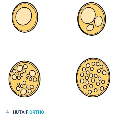 Monofascicular Oligofascicular