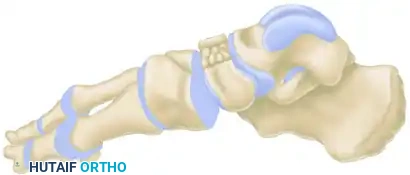 MIDFOOT FRACTURES AND DISLOCATIONS Surgical Diagram