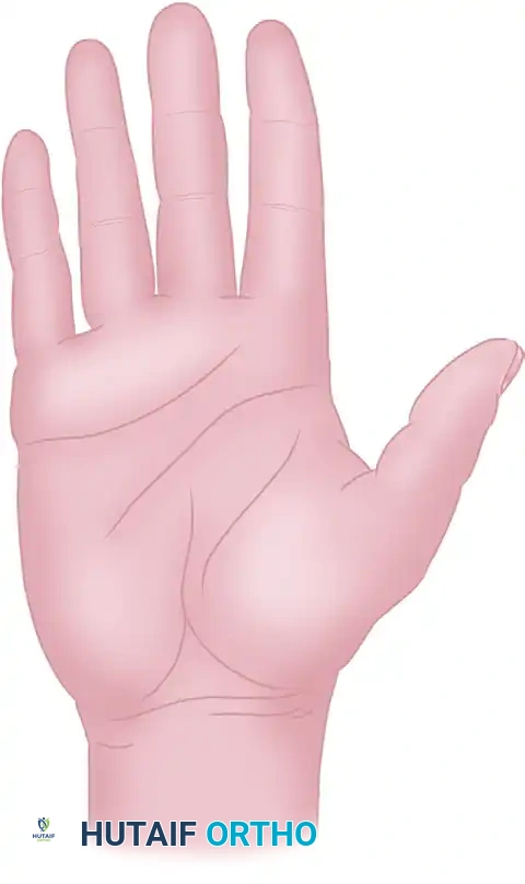 Midlateral Finger Incision: Comprehensive Surgical Technique and Applied Anatomy