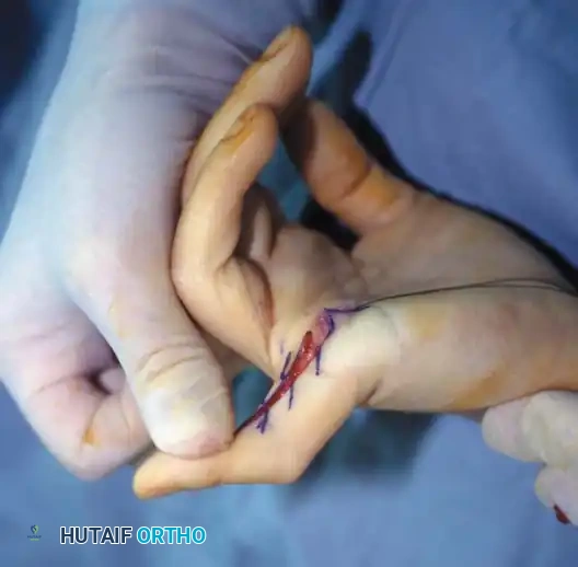 Hutaifortho's Orthopaedic Diagram