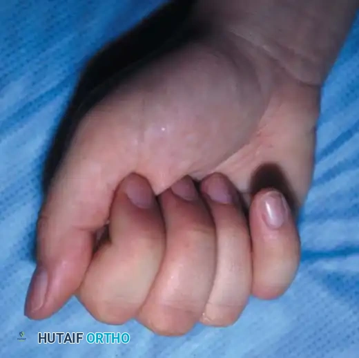 Hutaifortho's Orthopaedic Diagram