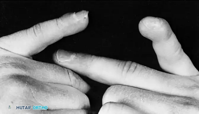 Hutaifortho's Orthopaedic Diagram