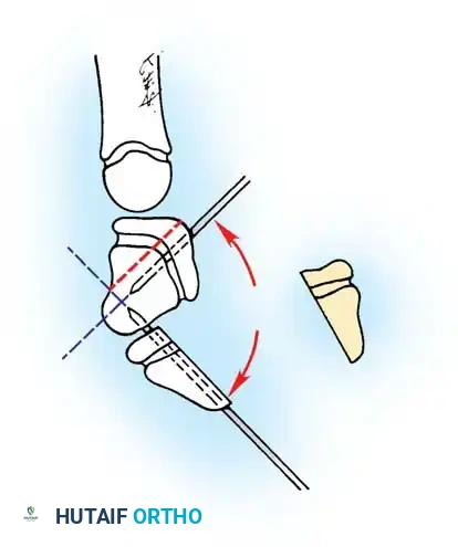 Hutaifortho's Orthopaedic Diagram