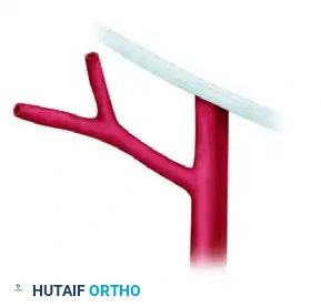 Microvascular Tissue Transfer: Postoperative Monitoring and Free Groin Flap Technique