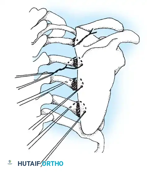 Hutaifortho's Orthopaedic Diagram