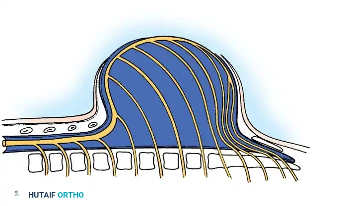 Skin and Neural Plaque Anatomy