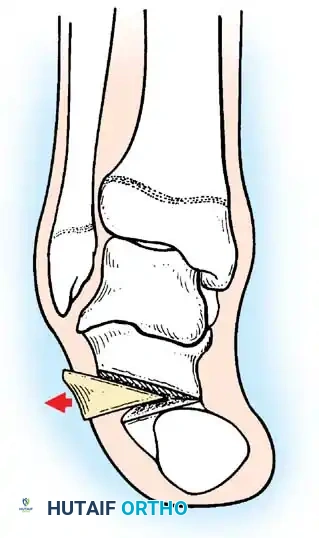 Hutaifortho's Orthopaedic Diagram