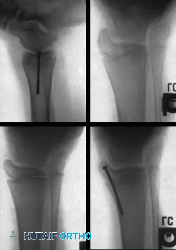 Neurological Level Chart