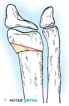 Hutaifortho's Orthopaedic Diagram