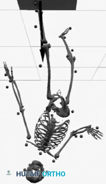 Hutaifortho's Orthopaedic Diagram