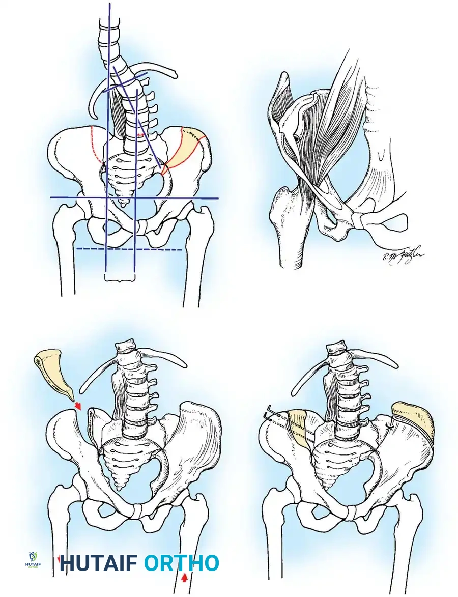 Latex Allergy Protocol