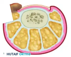 NAIL FOLD REMOVAL OR REDUCTION Surgical Diagram