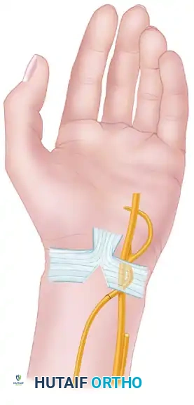 Deep Surgical Exposure