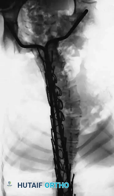 Hutaifortho's Orthopaedic Diagram