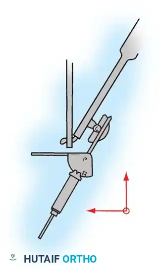 Hutaifortho's Orthopaedic Diagram