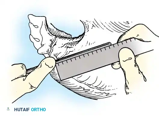 Hutaifortho's Orthopaedic Diagram