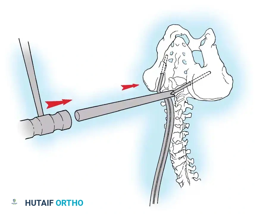 Hutaifortho's Orthopaedic Diagram