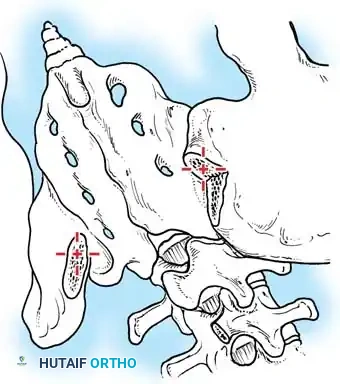 Hutaifortho's Orthopaedic Diagram