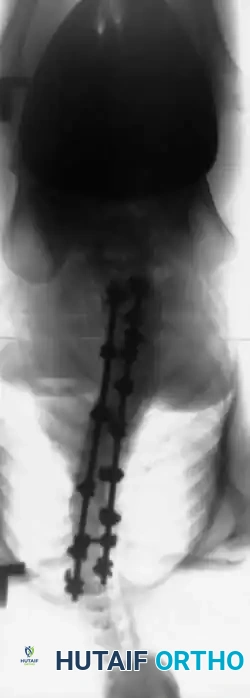 Hutaifortho's Orthopaedic Diagram