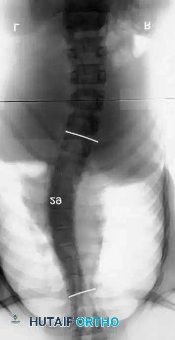 Hutaifortho's Orthopaedic Diagram