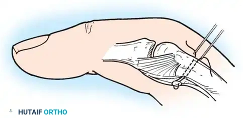 Hutaifortho's Orthopaedic Diagram