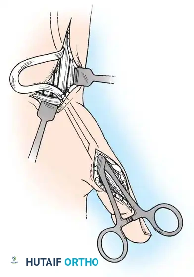 Hutaifortho's Orthopaedic Diagram