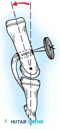 Hutaifortho's Orthopaedic Diagram