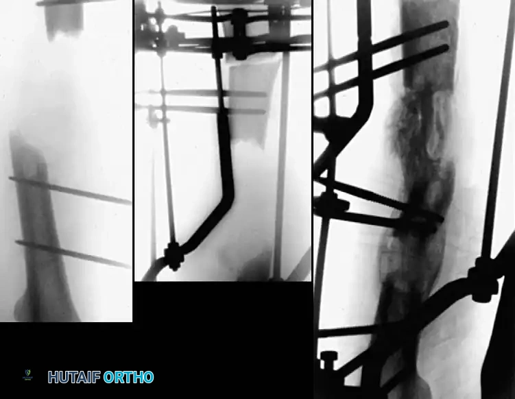 Hutaifortho's Orthopaedic Diagram