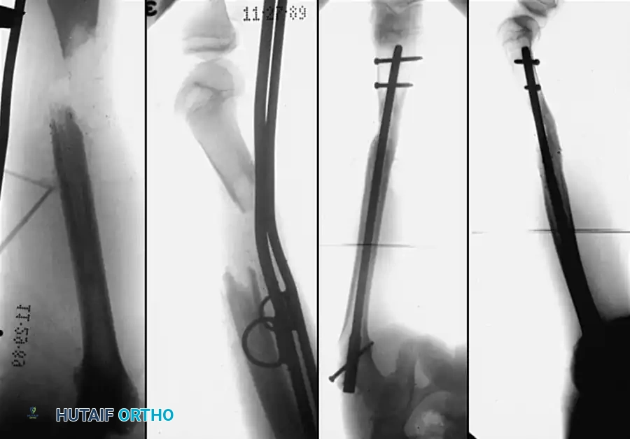 Hutaifortho's Orthopaedic Diagram