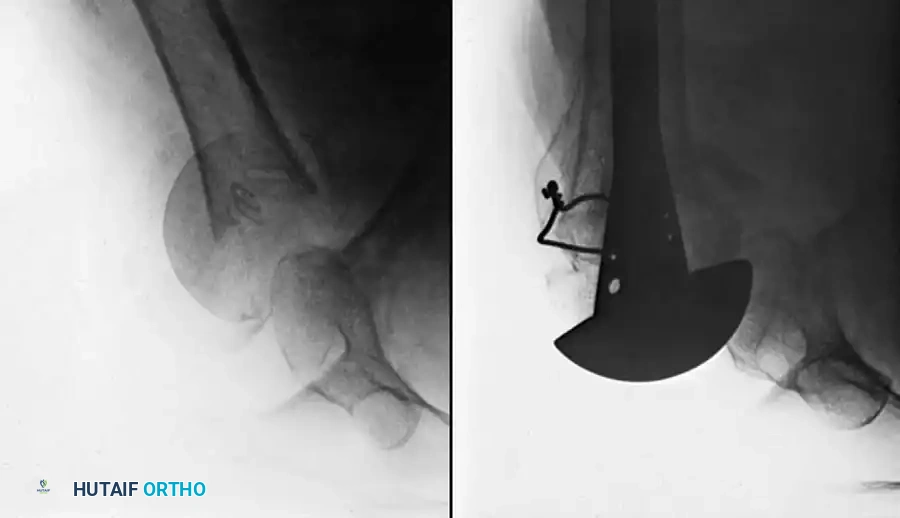 Hutaifortho's Orthopaedic Diagram