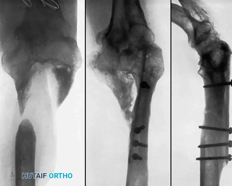 Hutaifortho's Orthopaedic Diagram