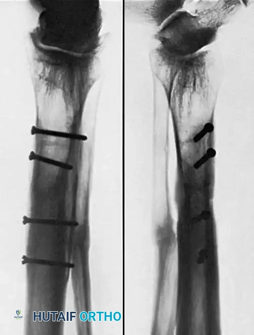 Hutaifortho's Orthopaedic Diagram