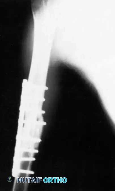 Hutaifortho's Orthopaedic Diagram