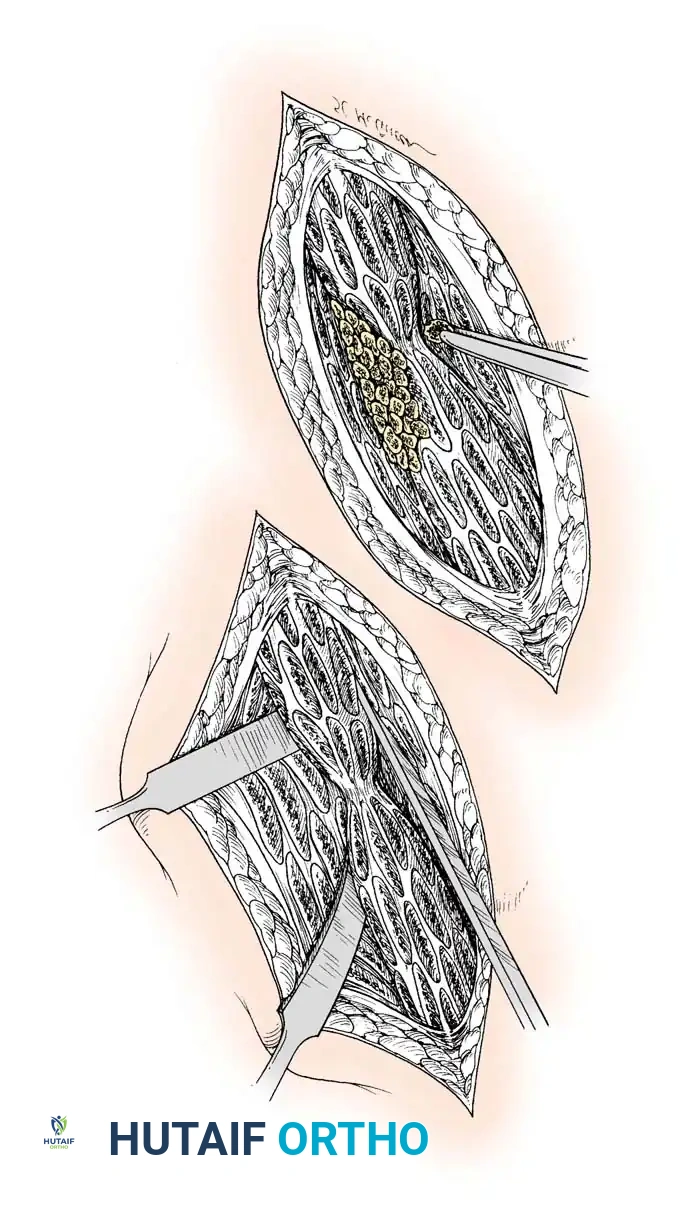 Hutaifortho's Orthopaedic Diagram