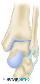 Neutral Eversion Inversion