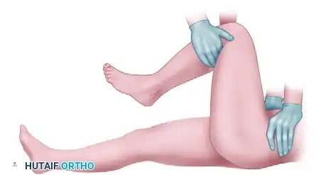 OPEN REDUCTION OF HIP DISLOCATION Surgical Diagram