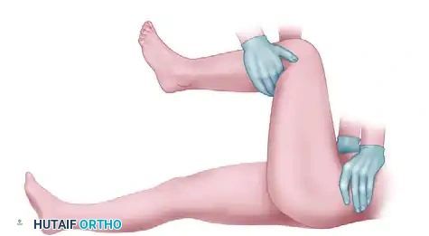 Mastering Open Reduction of Hip and Sternoclavicular Dislocations