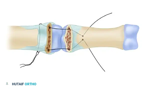 Hutaifortho's Orthopaedic Diagram