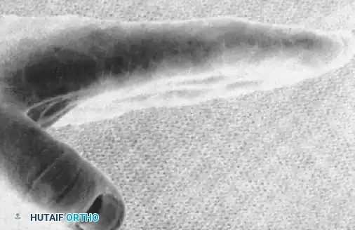 Hutaifortho's Orthopaedic Diagram