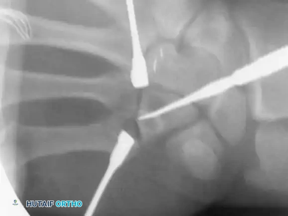 Hutaifortho's Orthopaedic Diagram