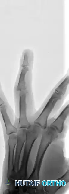 Hutaifortho's Orthopaedic Diagram