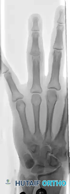 Hutaifortho's Orthopaedic Diagram