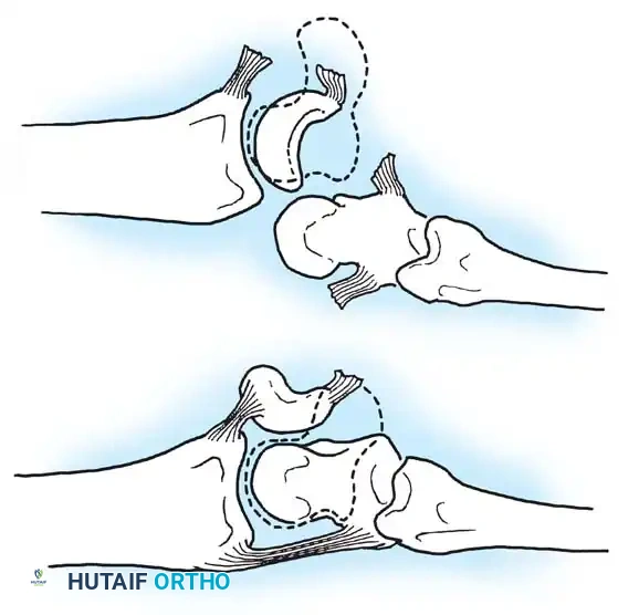 Hutaifortho's Orthopaedic Diagram